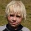 Faces of Fabry